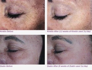 Pro+ Therapy MD Skin care - before and after photos