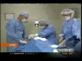 Silhouette sutures demonstration by Dr. Mest