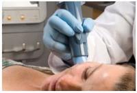 image thermage-treatment-2-jpg
